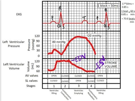 EKGs Flashcards Quizlet