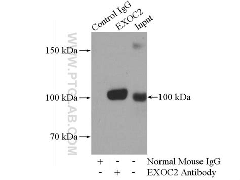 Sec5exoc2 Mouse Anti Human Mouse Porcine Rat Clone 1c11g2