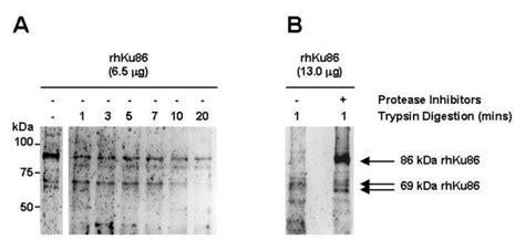 Trypsin Digestion Generates A 69 Kda Ku86 Protein From A Full Length Download Scientific