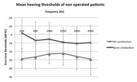 Mean Air And Bone Conduction Thresholds Of Non Operated Patients Download Scientific Diagram