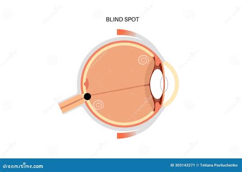 Blind spot poster stock vector. Illustration of optic - 303143271