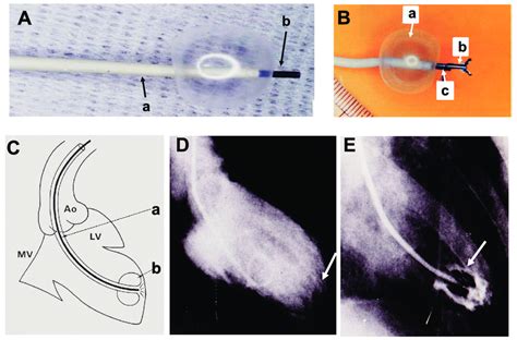 Cardioscope And Cardioscopy Procedure A Cardioscope A Guiding