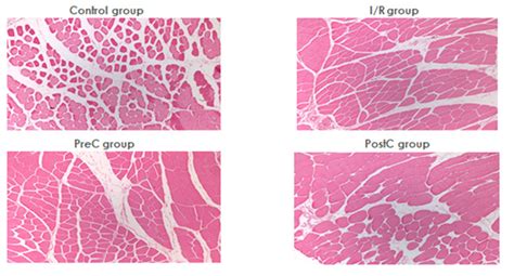 Representative Histological Slides Of The Skeletal Muscle Biopsies In