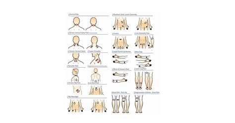 Tens Electrode Placement Chart User Manual