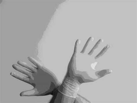 190+ Felon Finger Infection Stock Photos, Pictures & Royalty-Free ...