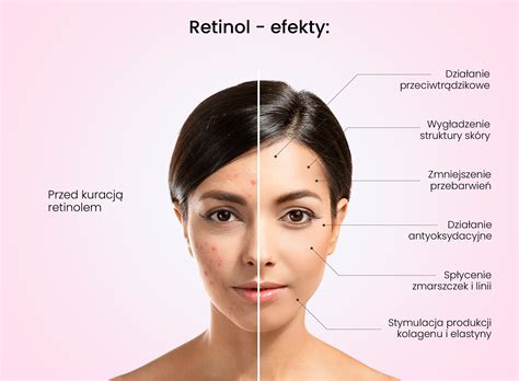 Retinol Jak Stosowa Pyta I Odpowiedzi Nasz Poradnik