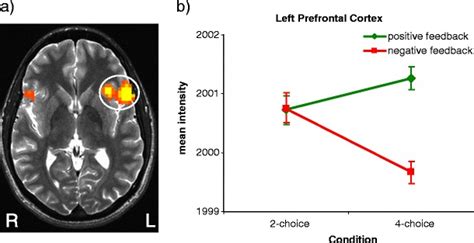 Left Prefrontal Cortex Activation Across Conditions A The Left Pfc