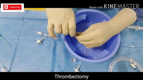 Preparation For Mechanical Thrombectomy Acute Ischemic Stroke Youtube