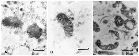 Immunocytochemical Localization Of Allantoinase In Isolated