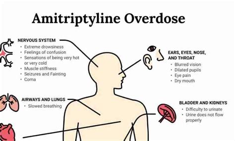 Amitriptyline Overdose: Symptoms And Treatment | Infographics Archive