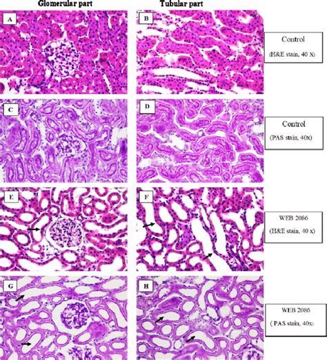 Representative Photomicrographs Of Kidney Sections Stained With H E A