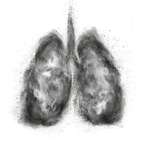 Black Lung Disease : Overview, Causes, Symptoms, Treatment - illness.com