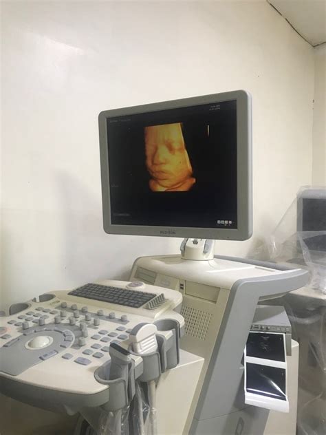 For Sale Ultrasound Samsung Medison Accuvix V10 With 3 Probes Covex