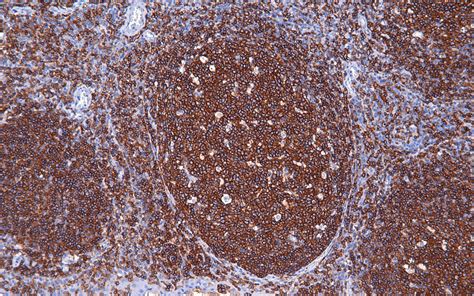 cd rabbit monoclonal antibodymab ihc p buy  abcepta