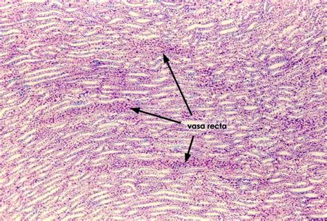 Kidney Medulla Histology Labeled