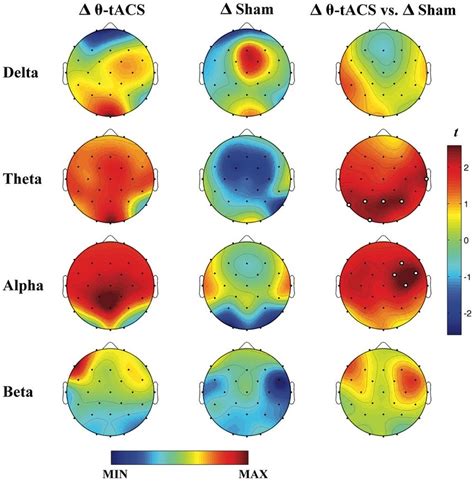 Cortical Effects Of θ Tacs Eeg Frequency Bands Resolution Topographic Download Scientific