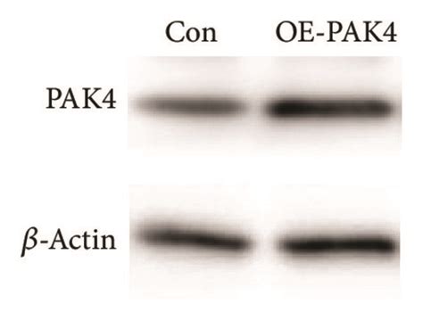 PAK4 Promotes Vascular Smooth Muscle Cells VSMCs Proliferation A