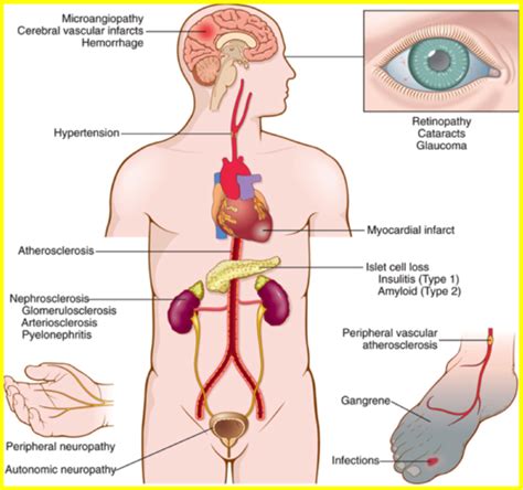 Pathology Endocrine System Flashcards Quizlet