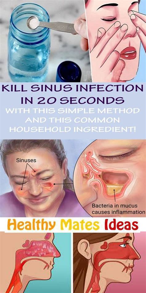 Kill Sinus Infection In 20 Seconds With This Simple Method And This