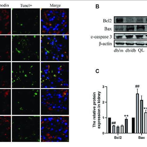 Effects Of Quercetin On Podocyte Apoptosis In Diabetic Mice A