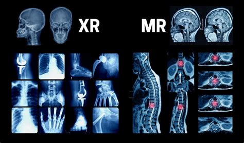 MRI vs X-Ray: What's The Difference?