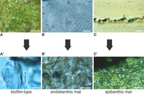 Different Types Of Microbial Colonization Photos In The Top Row A C