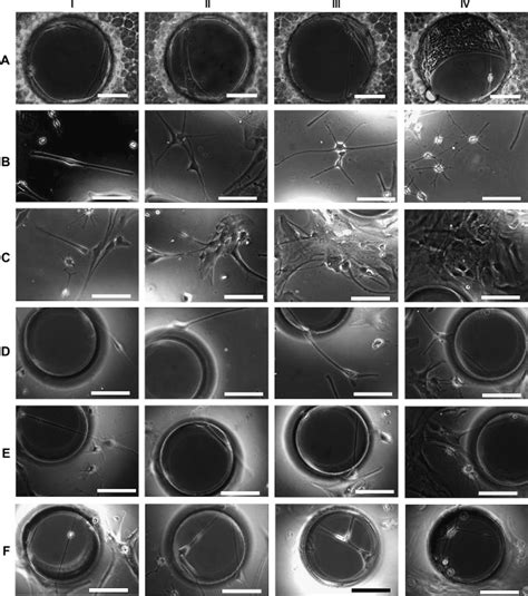 Phase Contrast Micrographs Of Cells In Cortical Astrocyte Cultures A