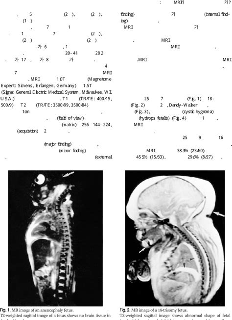 Figure 2 From Can Postmortem Fetal MR Imaging Replace Autopsy