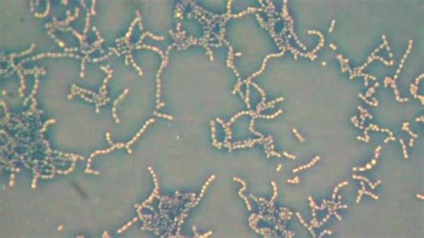 Bacteria under microscope ⬇ Video by © Dimarion Stock Footage #37984497