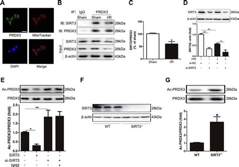 Prdx Is Deacetylated By Sirt In The Intestine A Localization Of