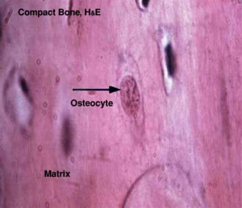 connective tissue bone