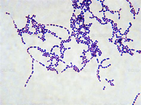 Streptococcus Spp. - Microbiology Laboratory Turkey