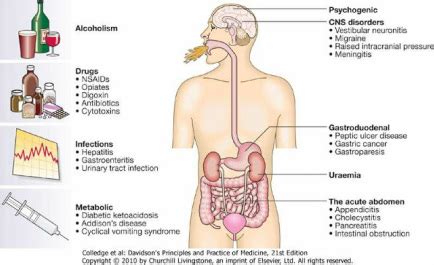 Causes of drowsiness and vomiting