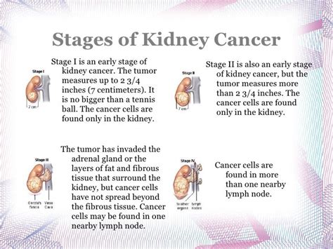 Is There A Stage 5 Kidney Cancer - CancerWalls