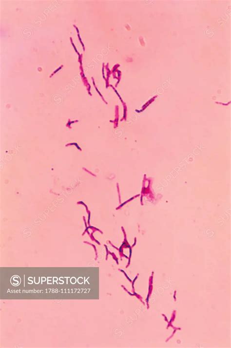 Mycobacterium Leprae Microscope