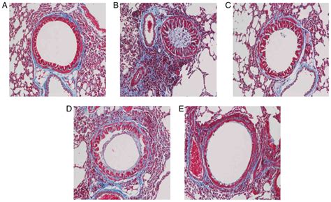 Osthole Attenuates Ovalbumininduced Lung Inflammation Via The