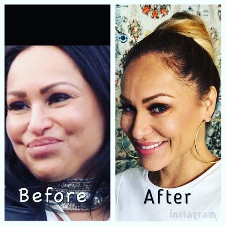 Darcey Silva Plastic Surgery - The Post Surgery Results Startled the ...