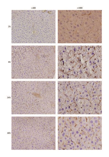 Immunohistochemistry Staining Of Vimentin In Liver Of Mice After Cona Download Scientific