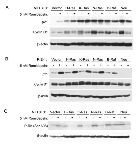 Romidepsin Inhibits Ras Dependent Growth Transformation Of NIH 3T3