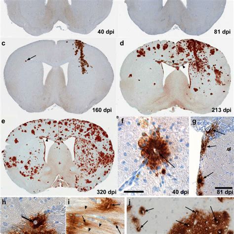 Immunohistochemistry For PrPres In Brains Of Tg44 Mice Following