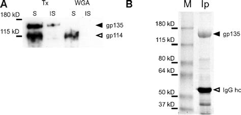 Figure From Gp Podocalyxin And Nherf Participate In The