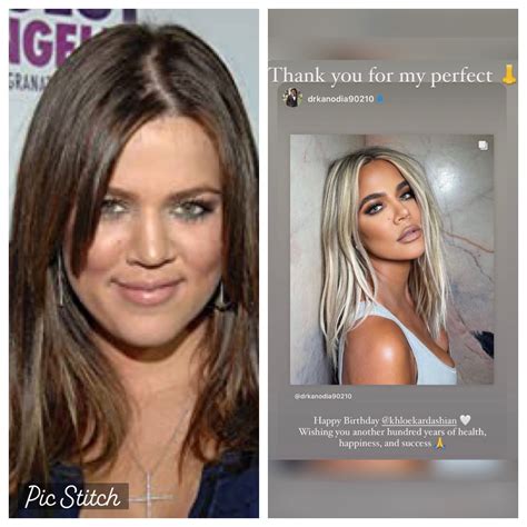 World Latin Honey on Twitter: "Khloe thanks her surgeon for her NOSE 👃