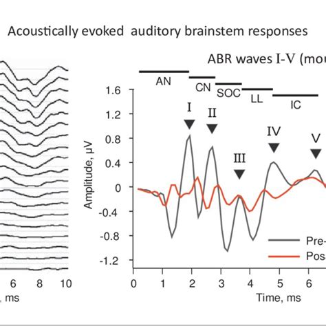 Acoustically Evoked Auditory Brainstem Responses ABR From Mice The