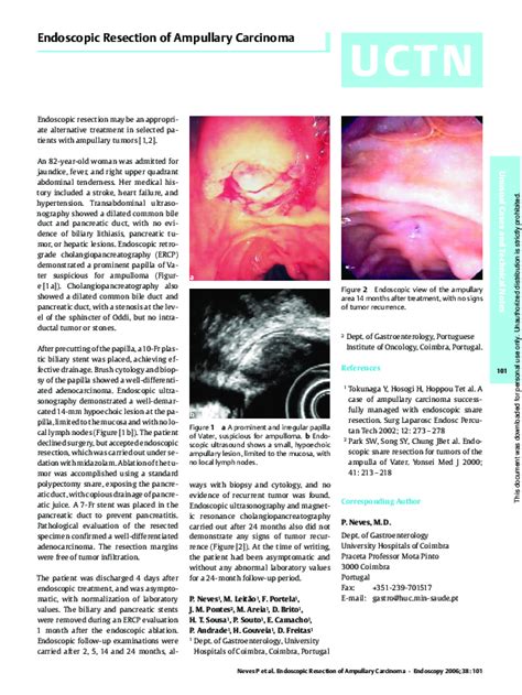 Pdf Endoscopic Resection Of Ampullary Carcinoma P Souto