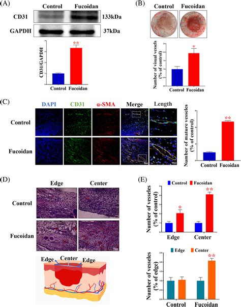 Fucoidan Promotes Angiogenesis And Accelerates Wound Healing Through