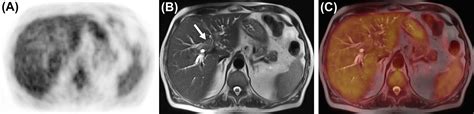 Hepatobiliary And Pancreatic Imaging Radiology Key