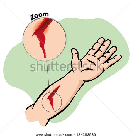 bleeding wound clipart - Clipground