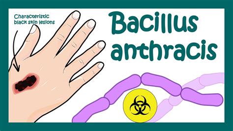 Anthrax Bacillus Anthracis What Does Bacillus Anthracis Do To Humans