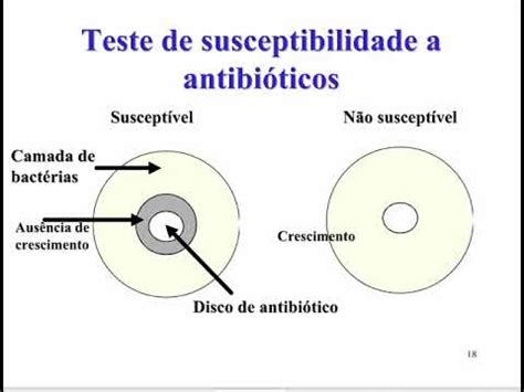 Aprenda Plugado BACTERIOLOGIA Aula 01 Slide 18 Teste De