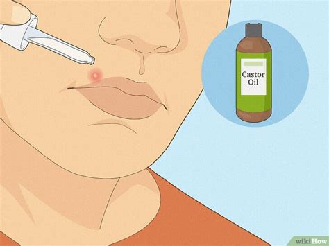 How to Get Rid of a Pimple on Your Lip: OTC & Home Remedies